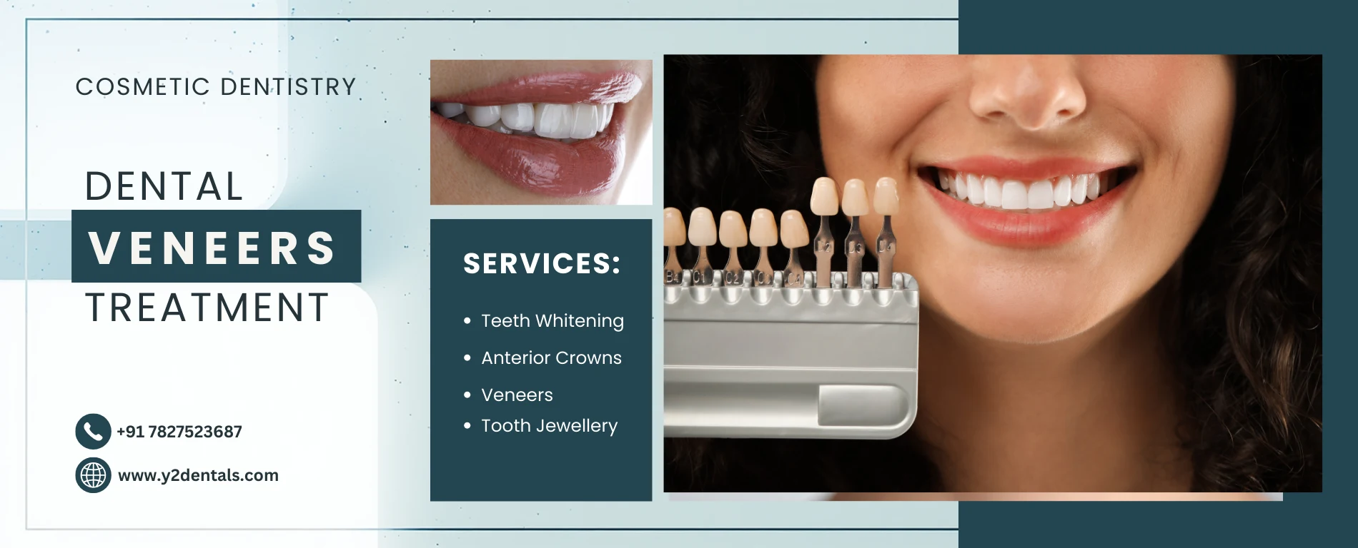 Veneers Treatment in Delhi